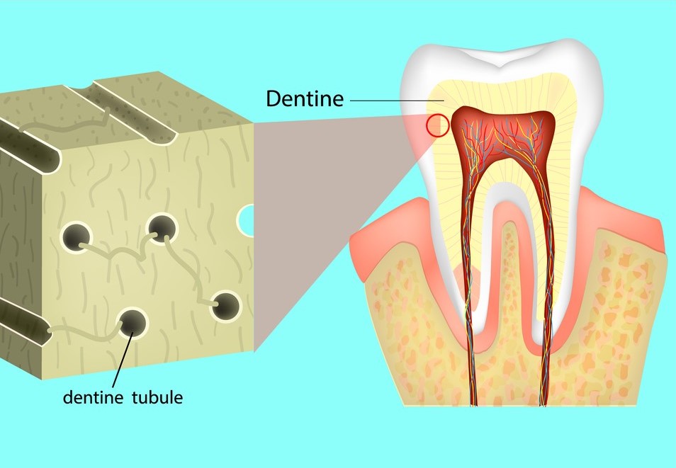 Understanding Tooth Sensitivity, A diagram of tooth sensitivity